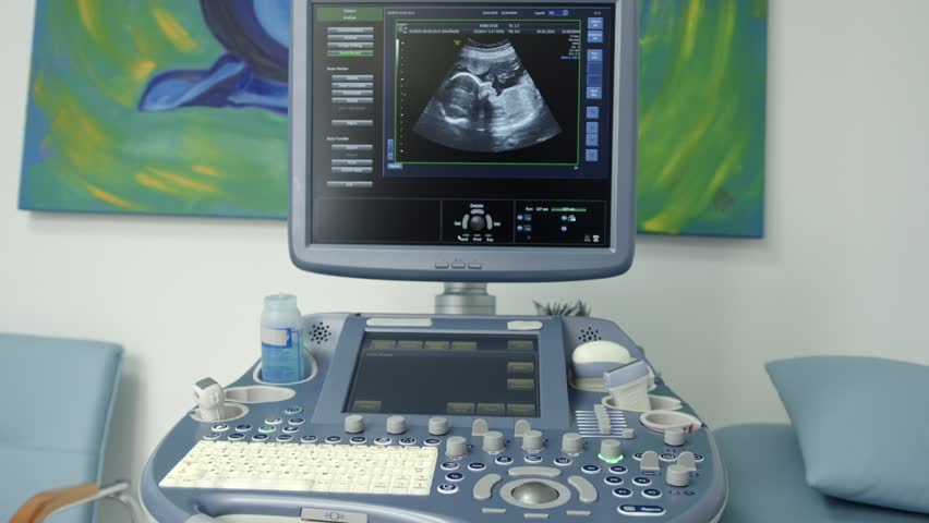 When It’s Time to Upgrade Your Ultrasound Machine | Techno FAQ