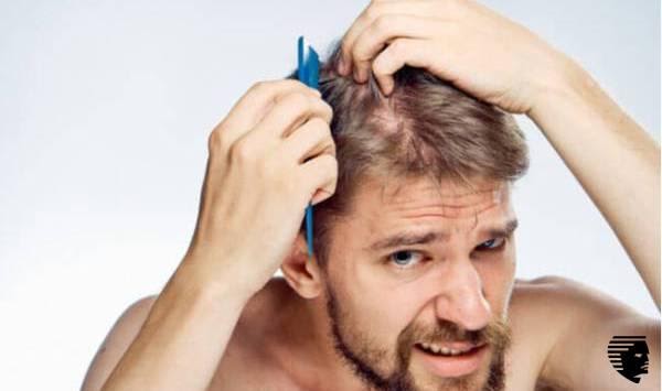 Going Bald? Consider Getting a Hair Loss Treatment Before it\u0026#39;s Too Late | Techno FAQ