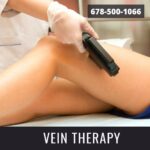 Varicose Vein | Everything You Need To Know